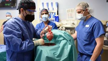 medizin - gestorbener patient mit schweineherz: schweinevirus gefunden